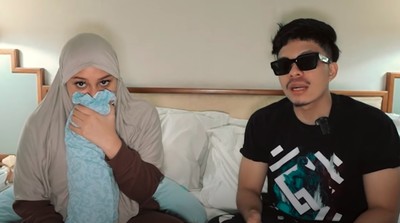 7 Foto Atta Halilintar Setelah Transplantasi Rambut, Pakai Poni & Kumisan