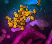 foto virus corona dilihat dari mikroskop