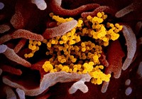 foto virus corona dilihat dari mikroskop