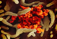 foto virus corona dilihat dari mikroskop