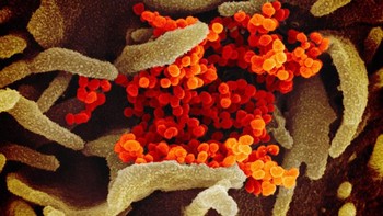 Wabah virus corona telah didokumentasikan di 25 negara, tetapi sebagian besar di China. Foto: National Institute of Allergy and Infectious Diseases. Foto: National Institute of Allergy and Infectious Diseases