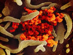 Wujud Virus Corona Dilihat dari Dekat, Mengerikan!