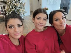 Pesona Superstar TikTok Terkaya, Raup Duit Rp 250 Miliar