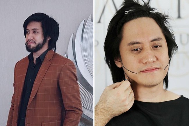 Kevin Aprilio sempat jadi viral menjalani transplantasi rambut di Turki. Perubahan penampilan Kevin begitu kontras. Tak hanya rambutnya yang tampak lebih tebal, namun Kevin juga tampil dengan jenggot setelah transplantasi di area wajah. Foto: Dok. Instagram, Youtube