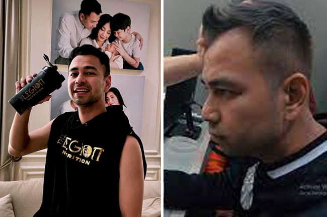 Pada 2019 silam, Raffi Ahmad melakukan transplantasi rambut di Korea Selatan. Pada saat itu, Raffi mulai insecure dengan rambutnya yang mulai menipis. Foto: Dok. Instagram, Youtube