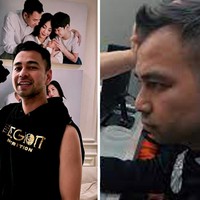 Pada 2019 silam, Raffi Ahmad melakukan transplantasi rambut di Korea Selatan. Pada saat itu, Raffi mulai insecure dengan rambutnya yang mulai menipis. Foto: Dok. Instagram, Youtube