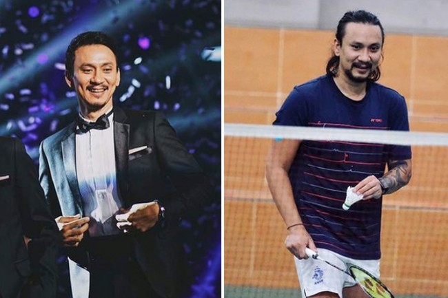 Vincent Rompies ternyata juga melakukan transplantasi rambut. Diketahui dia menjalaninya pada 2019. Kini rambut Vincent sudah tumbuh lebih lebat. Foto: Dok. Instagram, Youtube