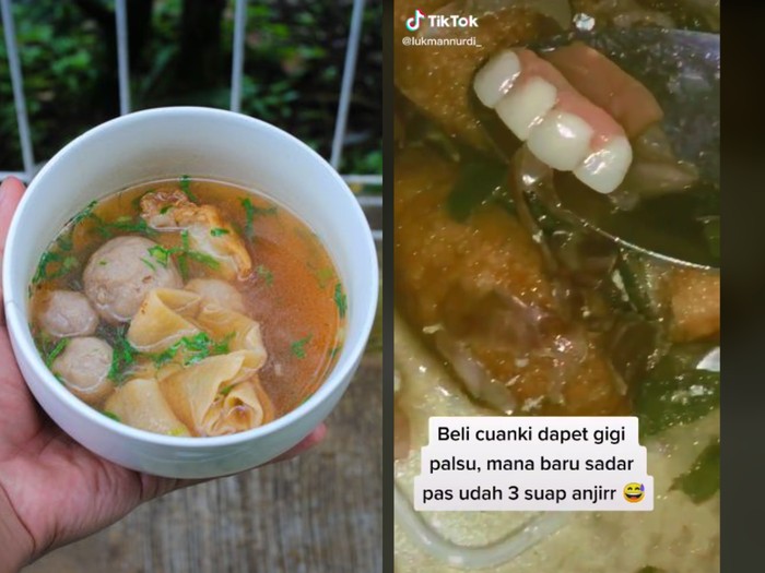 Nemu gigi palsu saat beli cuanki Nemu gigi palsu saat beli cuanki