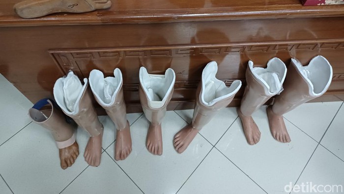 Bantuan Kaki dan Tangan Palsu untuk Penyandang Disabilitas di Kabupaten Bandung Para penyandang Disabilitas diberi bantuan kaki dan tangan palsu oleh Pemerintah Daerah (Pemda) Kabupaten Bandung, di Gedung Moh Toha, Soreang, Jumat (21/1/2022).