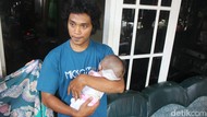 Kasihan, Bayi 7 Bulan di Jombang Menderita Hydrocephalus