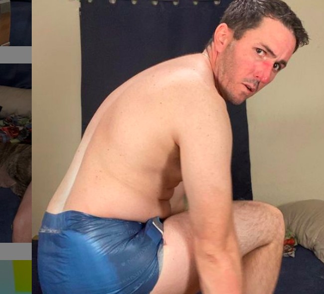 Marc mengenakan popok dewasa setiap harinya karena didiagnosa penyakit neuropati perifer pada usia 25 tahun. Kondisi tersebut mengganggu sistem saraf perifer sehingga sulit mengontrol buang air kecil dan buang air besar.Foto: dok. Instagram/@diaperdynamo