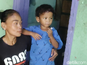 Heboh Bocah di Cianjur Disunat Gaib, Ini Penjelasan Dinkes