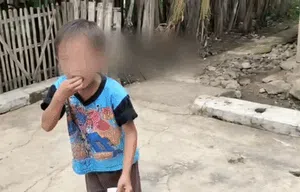 Bocah Cianjur Pemakan Papir Bikin Heboh, Ini Kondisinya Sekarang