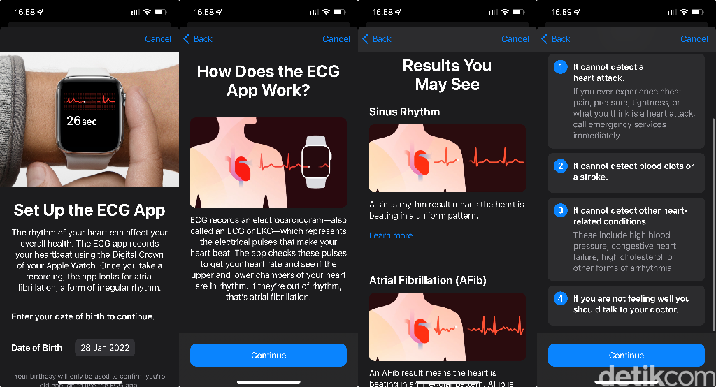 Akhirnya Fitur EKG Apple Watch Bisa Dipakai di Indonesia