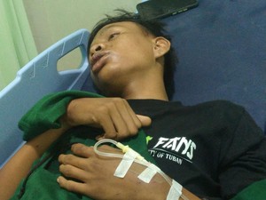 Enam Bonek Dianiaya Anak Punk, Satu Masuk Rumah Sakit