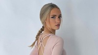 Harriet Robson kini mendapatkan dukungan dari banyak orang karena berani mengungkap perlakuan kasar sang kekasih. Foto: Instagram Harriet Robson