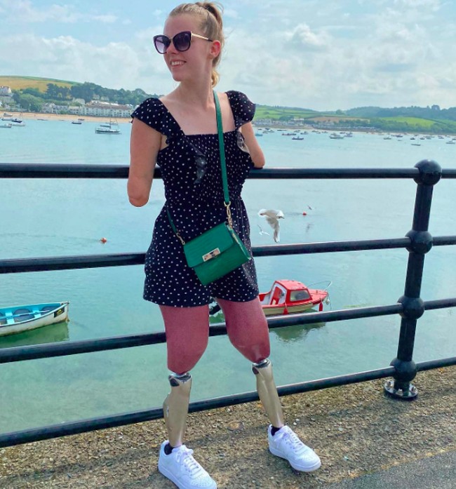 Tanpa tangan dan kaki, Isabelle terlihat mandiri. Dia bahkan bekerja sebagai asisten marketing di salah satu perusahaan mobil. Foto: dok. Instagram/@itz.izz