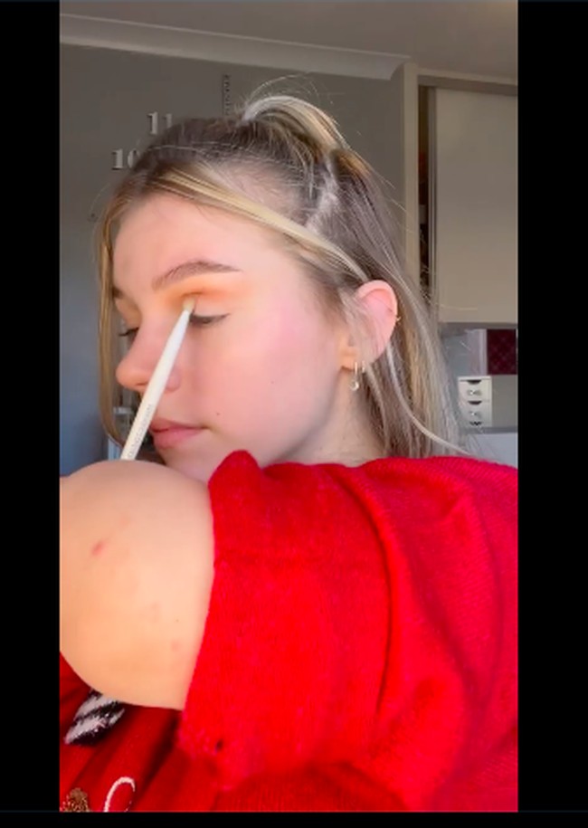 Jantungnya kemudian berhenti bekerja, dan dia beberapa kali mengalami gagal organ hingga koma. Dia kemudian diamputasi untuk menyelamatkam nyawanya. Foto: dok. Instagram/@itz.izz