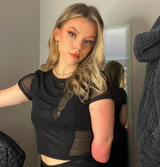 Eyeshadow neon, winged eyeliner, dan bulu mata palsu digunakan dengan lihai oleh influncer bernama Isabelle Weall. Hal tersebut mungkin biasa bagi remaja umumnya, namun menjadi luar biasa bagi Isabelle karena tangan dan kakinya diamputasi. Foto: dok. Instagram/@itz.izz