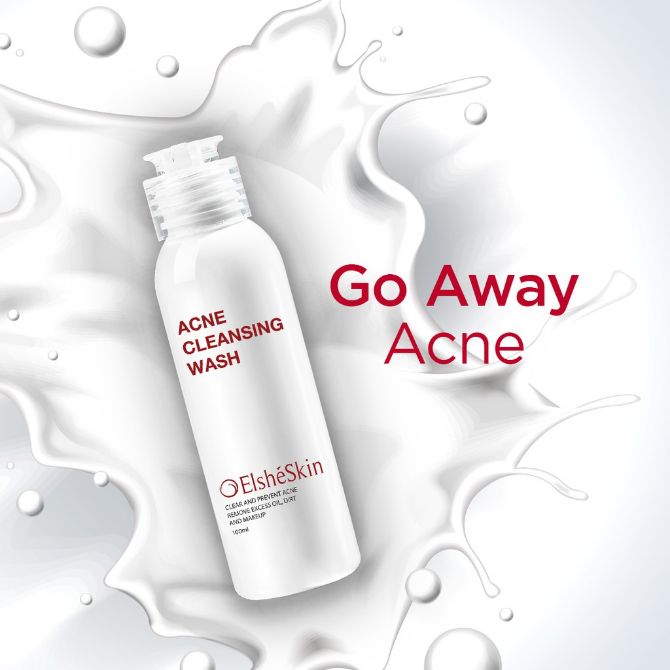 Rekomendasi 8 Facial Wash untuk Kulit Berminyak dan Berjerawat Rekomendasi 8 Facial Wash untuk Kulit Berminyak dan Berjerawat