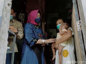 Pilu Balita di Surabaya Alami Kelainan Kelamin di Tengah Kemiskinan Keluarga