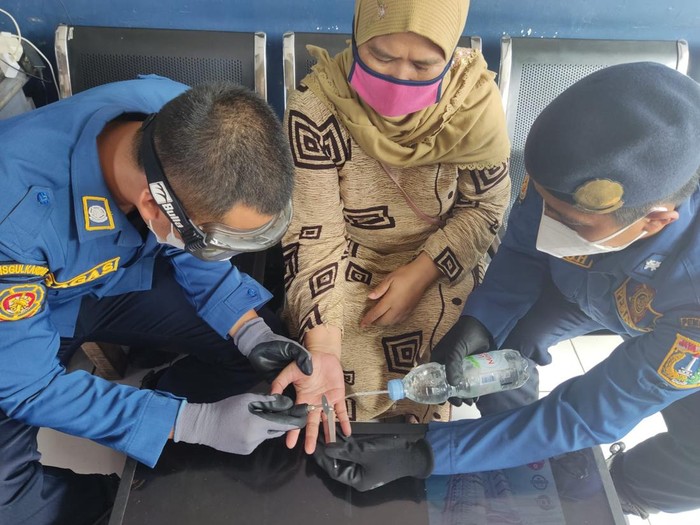 Proses pelepasan cincin (Dok istimewa)