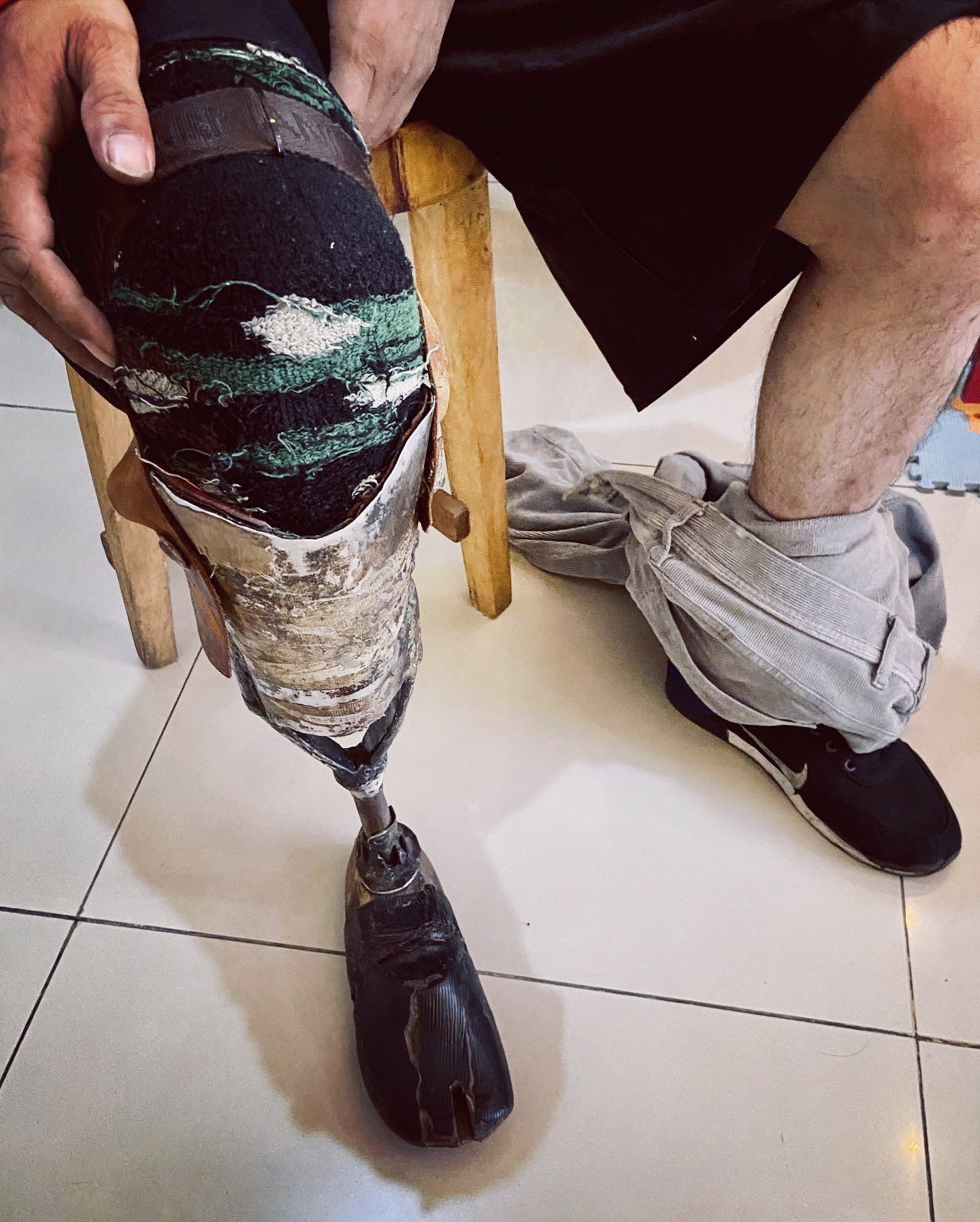 Coki Tobing pembuat kaki palsu (prostesis dan ortosis). (Dok pribadi Coki Tobing)