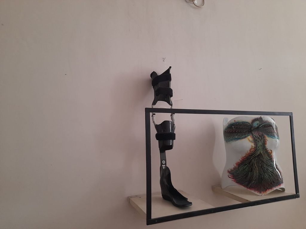 Coki Tobing pembuat kaki palsu (prostesis dan ortosis). (Dok pribadi Coki Tobing)