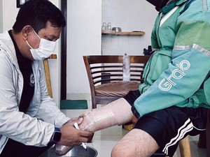 Viral! Kebaikan Hati Coki Bantu Ojol yang Diamputasi Dapatkan Kaki Lagi