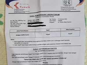 Minta Maaf, Ini Klarifikasi Pasutri COVID-19 Jalan-jalan ke Malang
