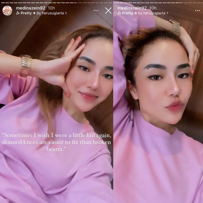 Setelah membuat unggahan video tampil lepas hijab, Medina Zein mengunggah quote tentang patah hati. Kadang-kadang patah hati untuk membuat kita terjaga dan membantu kita melihat bahwa kita bernilai jauh lebih banyak daripada yang kita tetapkan, tulisnya. Selain mengunggah video memakai piyama Louis Vuitton, Medina Zein juga membagikan foto selfie dengan mengenakan sweater warna lilac. Dia pun kembali curhat kegalauannya. Medina berharap bisa tumbuh kembali seperti anak-anak yang dapat dengan mudah memperbaiki jika sedang gundah. Foto: Dok. Instagram @medinazein92.