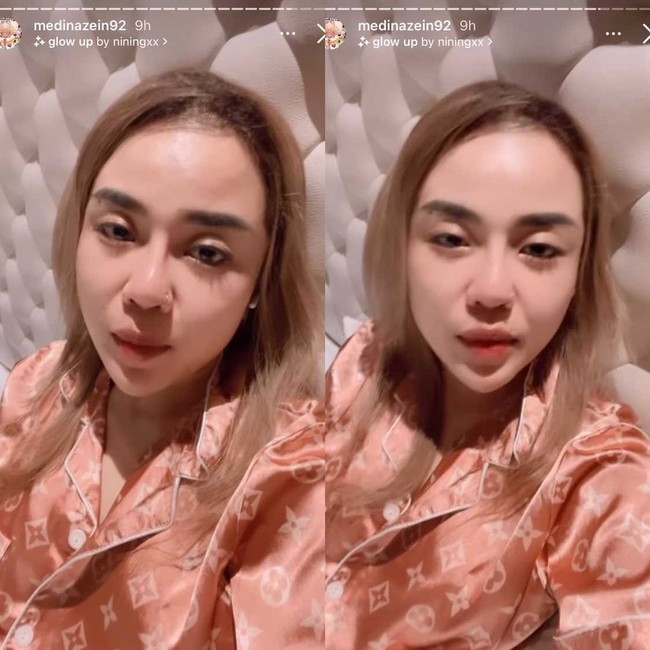 Setelah dulu populer karena kesuksesan bisnisnya hingga dijuluki crazy rich, kini Medina Zein jadi perbincangan publik karena mengunggah foto lepas hijab di akun Instagram @medinazein92. Ia membuat video lewat Instagram Story yang menjelaskan penampilan terbarunya saat ini. Foto: Dok. Instagram @medinazein92.