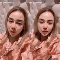 Setelah dulu populer karena kesuksesan bisnisnya hingga dijuluki crazy rich, kini Medina Zein jadi perbincangan publik karena mengunggah foto lepas hijab di akun Instagram @medinazein92. Ia membuat video lewat Instagram Story yang menjelaskan penampilan terbarunya saat ini. Foto: Dok. Instagram @medinazein92.