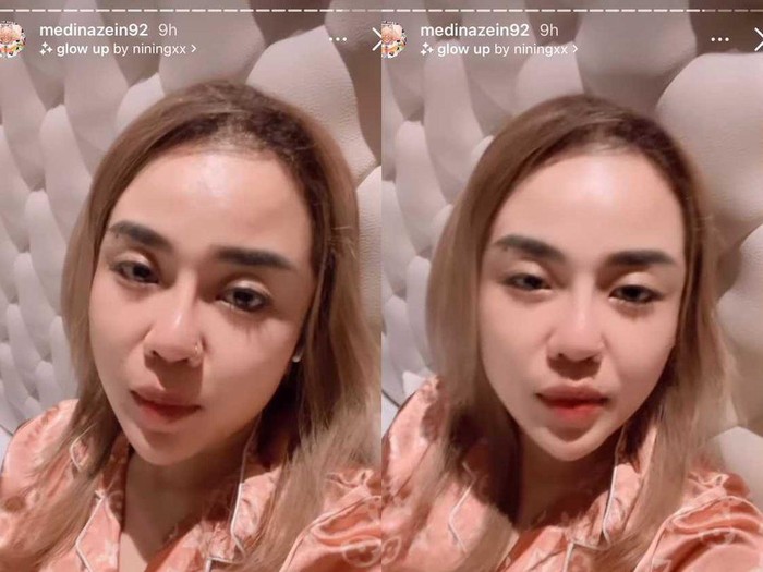 Selebgram Medina Zein unggah video dan foto lepas hijab. Selebgram Medina Zein unggah video dan foto lepas hijab.