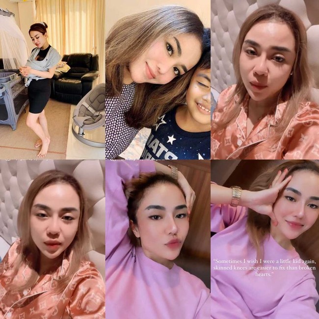 Dalam video unggahannya di Instagram Story, wanita kelahiran 23 Mei 1992 itu mengaku tengah menerima banyak hujatan. Meski demikian kata Medina, dia akan tetap menjadi dirinya sendiri. Oke, mungkin kalian kaget atau bagaimana meliat penampilan aku sekarang. Tapi inilah aku sekarang. Walaupun sekarang terlalu banyak hujatan, ungkap Medina Zein yang sedang berada di atas kasur. Foto: Dok. Instagram @medinazein92.