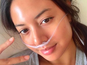 Aurelie Moeremans Pakai Selang Oksigen, Sakit Apa?