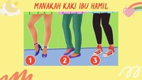 Salah satunya ibu hamil, bisa tebak yang mana kakinya?