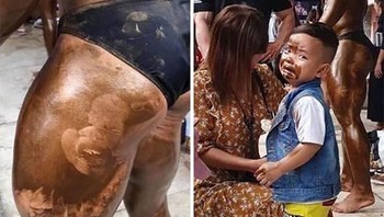 Mukanya menempel, kena minyak deh...Foto: Kids in Predicaments