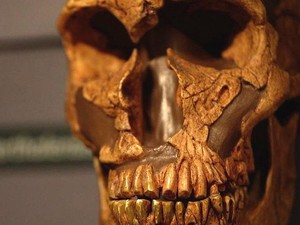 Studi: Orang dengan Variasi Gen Tertentu Lebih Sensitif pada Rasa Sakit