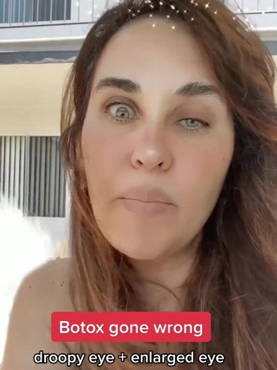 Wanita gagal botox Wanita gagal botox