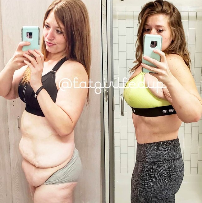 Tampak before - after setelah Lexi menjalani operasi penghilangan kulit berlebih. Tampak tubuh wanita asal Indiana, AS itu menjadi lebih fit. Foto: dok. Instagram/@fatgirlfedup