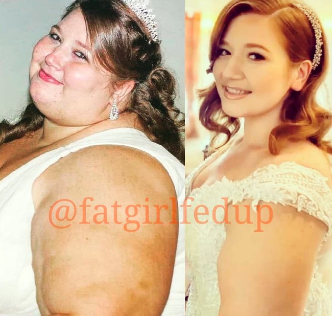 Setelah lebih kurus, Lexi kembali melakukan pemotretan dengan baju pernikahan. Beautiful then and beautiful now. Worthy then and worthy now,” begitu keterangan fotonya. Foto: dok. Instagram/@fatgirlfedup