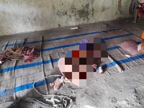 Bocah di Ngawi diikat di tilang rumah selama 2 tahun. Kedua kaki bocah itu diikat bukan tanpa alasan.