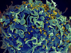 Seorang Wanita Berhasil Sembuh dari HIV Berkat Terapi Sel Punca