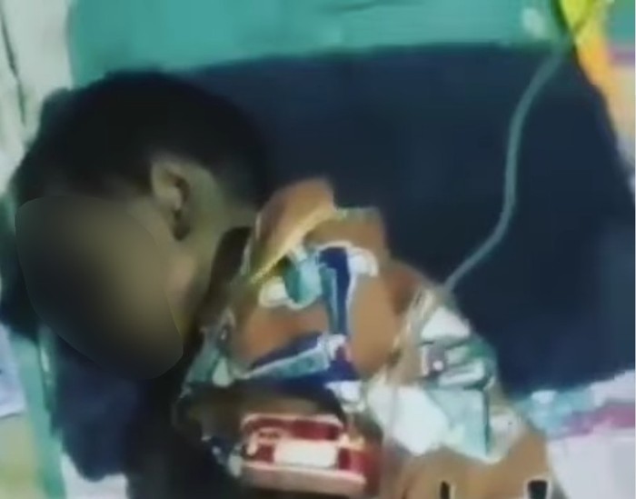 Sebuah video menunjukkan seorang bocah diduga kekurangan gizi di Kabupaten Bekasi, Jabar, viral di medsos. Ternyata bocah tersebut penyintas HIV/AIDS. (Screenshot video viral)