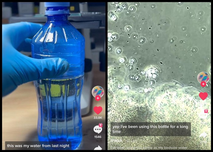 Uji Mikroskop Ungkap Air Minum di Botol yang Jarang Diganti Terbukti Kotor