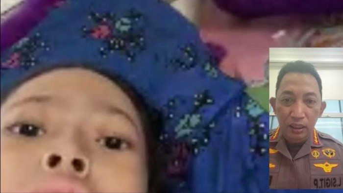 Kapolri Jenderal Listyo Sigit video call dengan Sinta, bocah pengidap tumor tulang