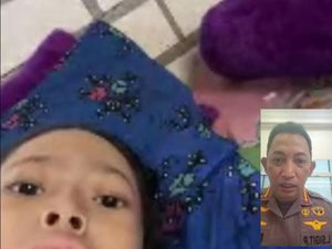 Kapolri Hubungi Bocah Penderita Tumor Tulang, Segera Kirim Tim Dokter