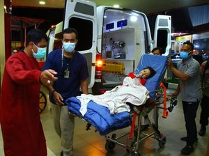 RSCM Sebut Pengobatan Sinta Usai Operasi Tumor Selesai dalam 4 Bulan