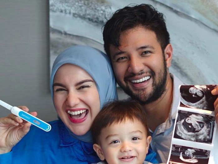 Irish Bella hamil anak kedua.